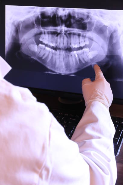 Best Emergency Denture Repair in Mckeesport, PA