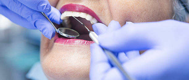 Best Emergency Tooth Extraction in Mckeesport, PA